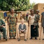 Burkina Faso : l&rsquo;inclusion des handicapés physiques, un défi social