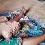 Au village de Koin, le Godo traite les fractures