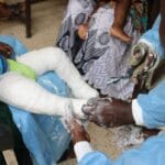 Burkina Faso : célébration de la journée mondiale du pied bot