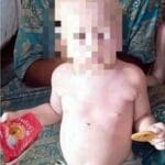 Madagascar : crimes rituels contre les albinos persistent en 2026